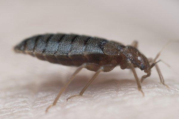 bed bug biting skin