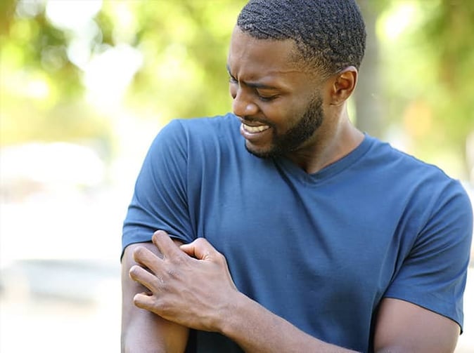 phoenix resident scratching mosquito bite