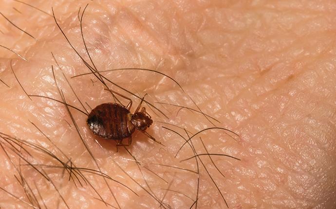 a bed bug on a mans hand