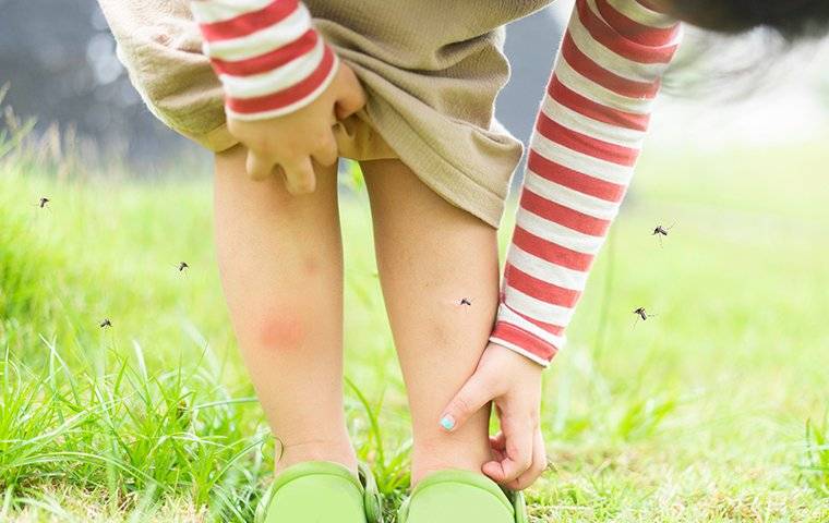a child scratching mosquito bites on her leg