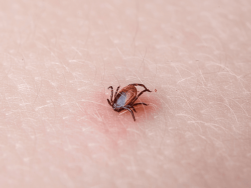 tick biting new jersey resident
